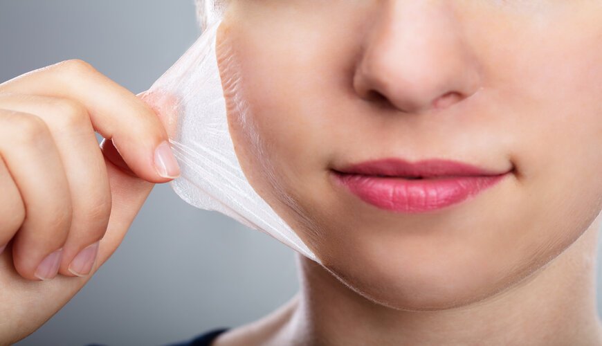Tránh tình trạng da khô và giúp da được dưỡng ẩm hơn